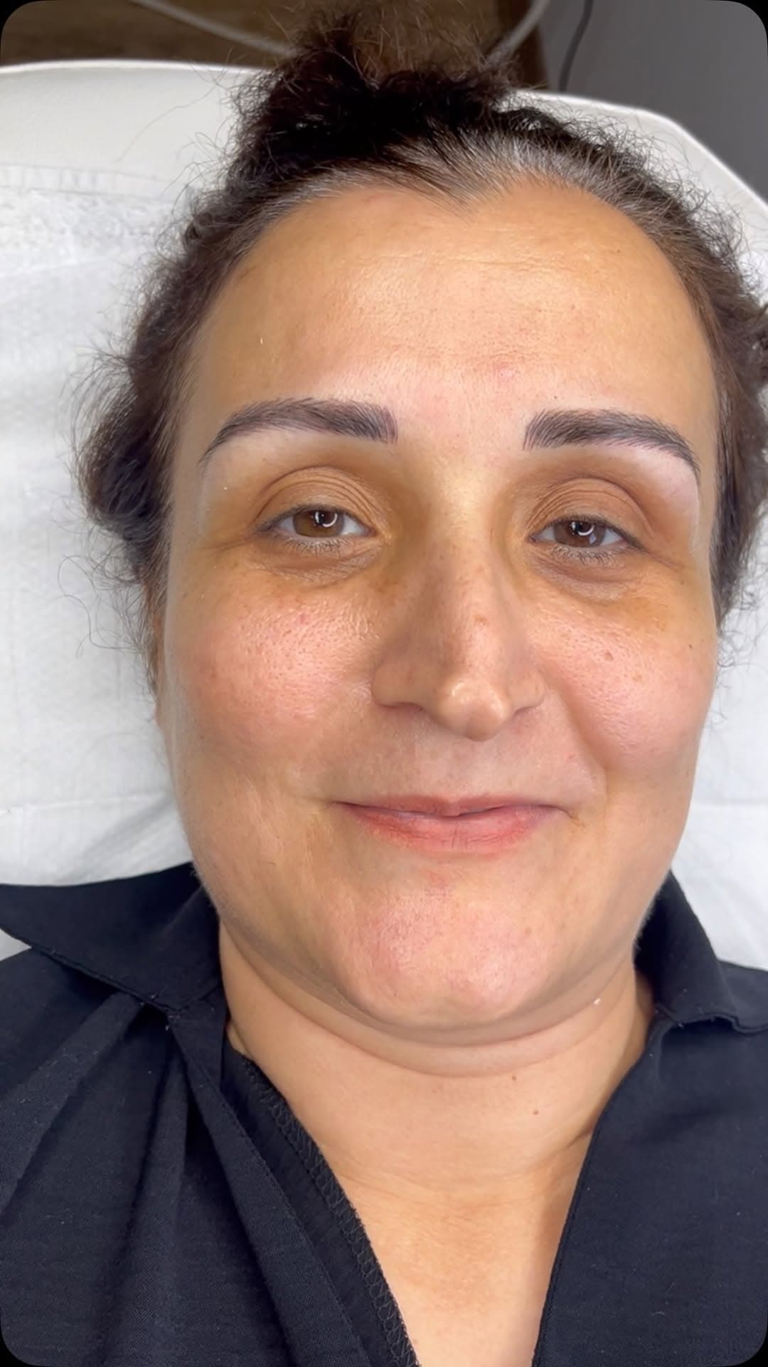 Kaş dizayn sonrası dengeli form